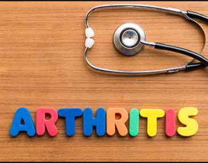 How-ro-manage-arthritis